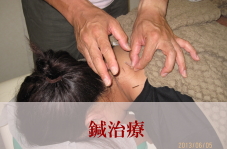 鍼治療